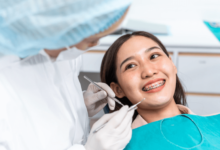 Aligning Your Dental Care with Your Lifestyle: Discover Available Plans