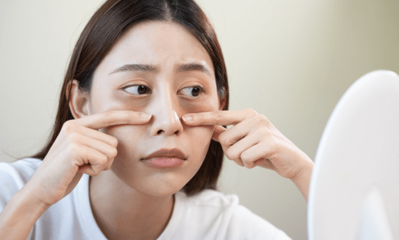 How Face Yoga Can Reduce Puffiness and Eye Bags