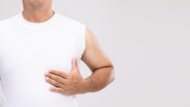Gynecomastia