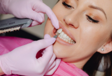 How Digital Smile Design Revolutionizes Cosmetic Dentistry